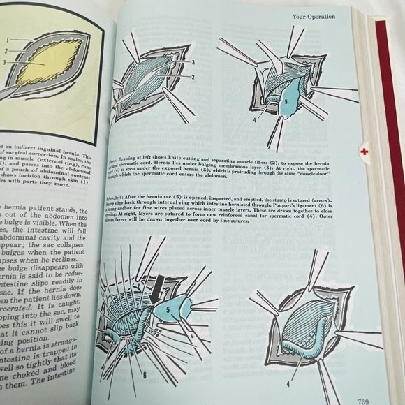 Better Homes And Gardens' Family Medical Guide 1976 Largre Book with Sleeve - Picture 13 of 16